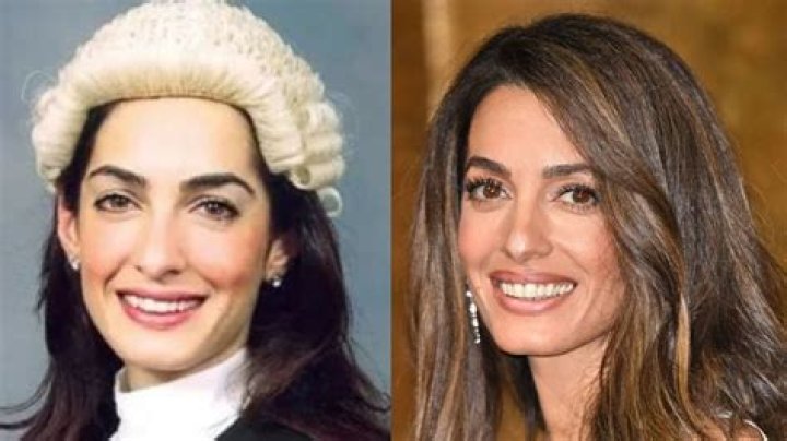 Amal Clooney Plastic Surgery
