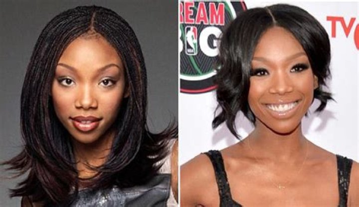Brandy Norwood Botox, Plastic Surgery Before And After