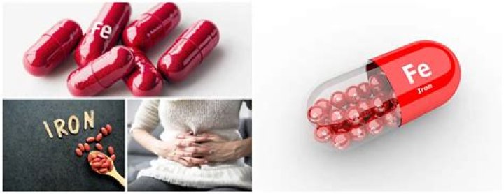Can iron pills cause constipation?