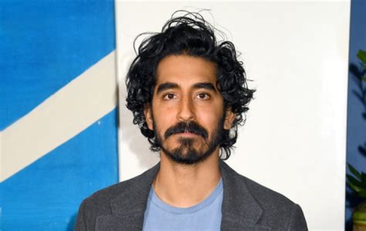 Dev Patel scar celebsfortune.com