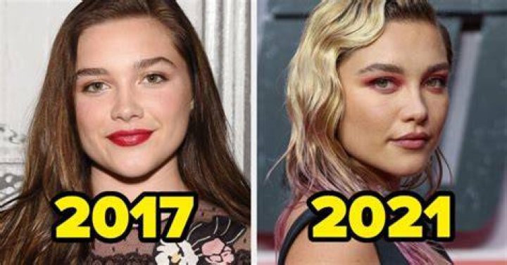 Florence Pugh Plastic Surgery