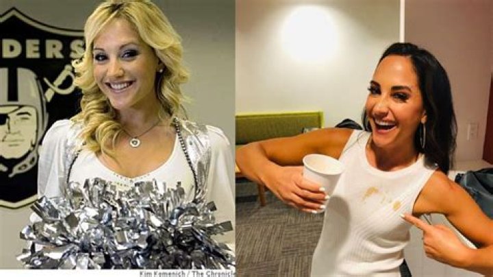 Here The Real Reason Why Emily Compagno Got Plastic Surgery