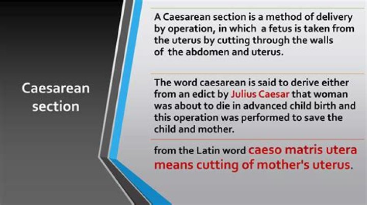 Is the word cesarean capitalized?